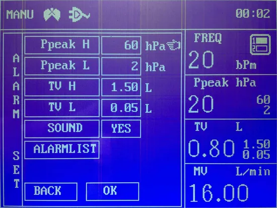 ICU Touch Screen Anesthesia Machine for Adult & Pediatric